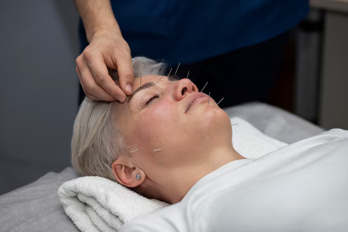 Acupuncture Therapy