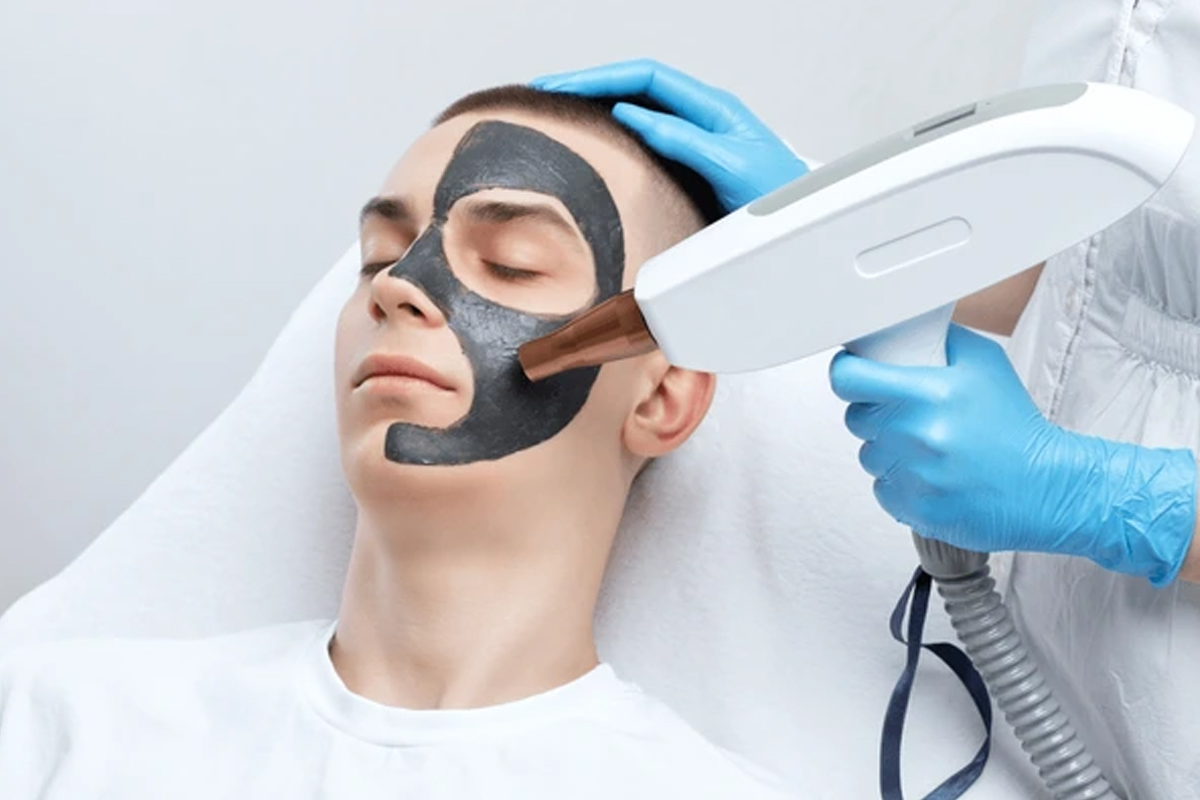Carbon Laser Treatment
